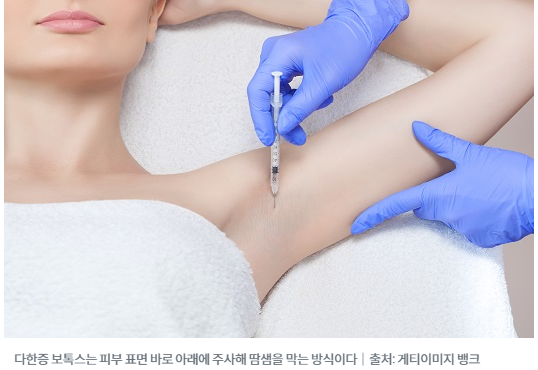 목동/여의도/ 스텔라 직원이 추천하는 ☞ 여름 시술 (1) 겨드랑이 다한증 보톡스 관련 이미지 1