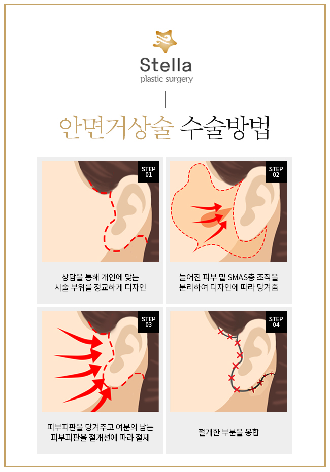 ★목동/영등포/오목교 스텔라의원 크리스 제너의 회춘 비밀🤫 관련 이미지 3