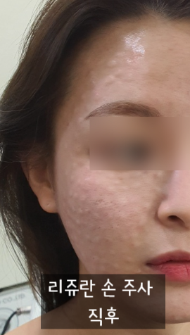 9월의 시작은 스텔라와 함께 리쥬란 하세요! 관련 이미지 6