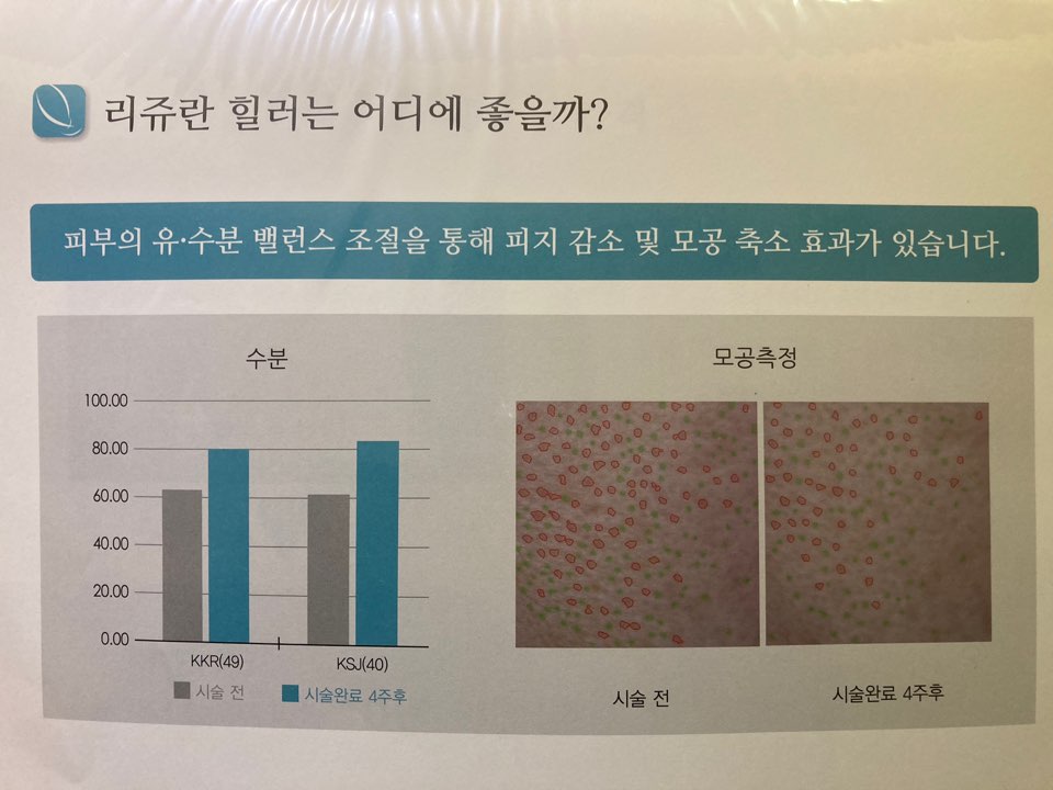 리쥬란 힐러 (피부재생)이벤트! 관련 이미지 6