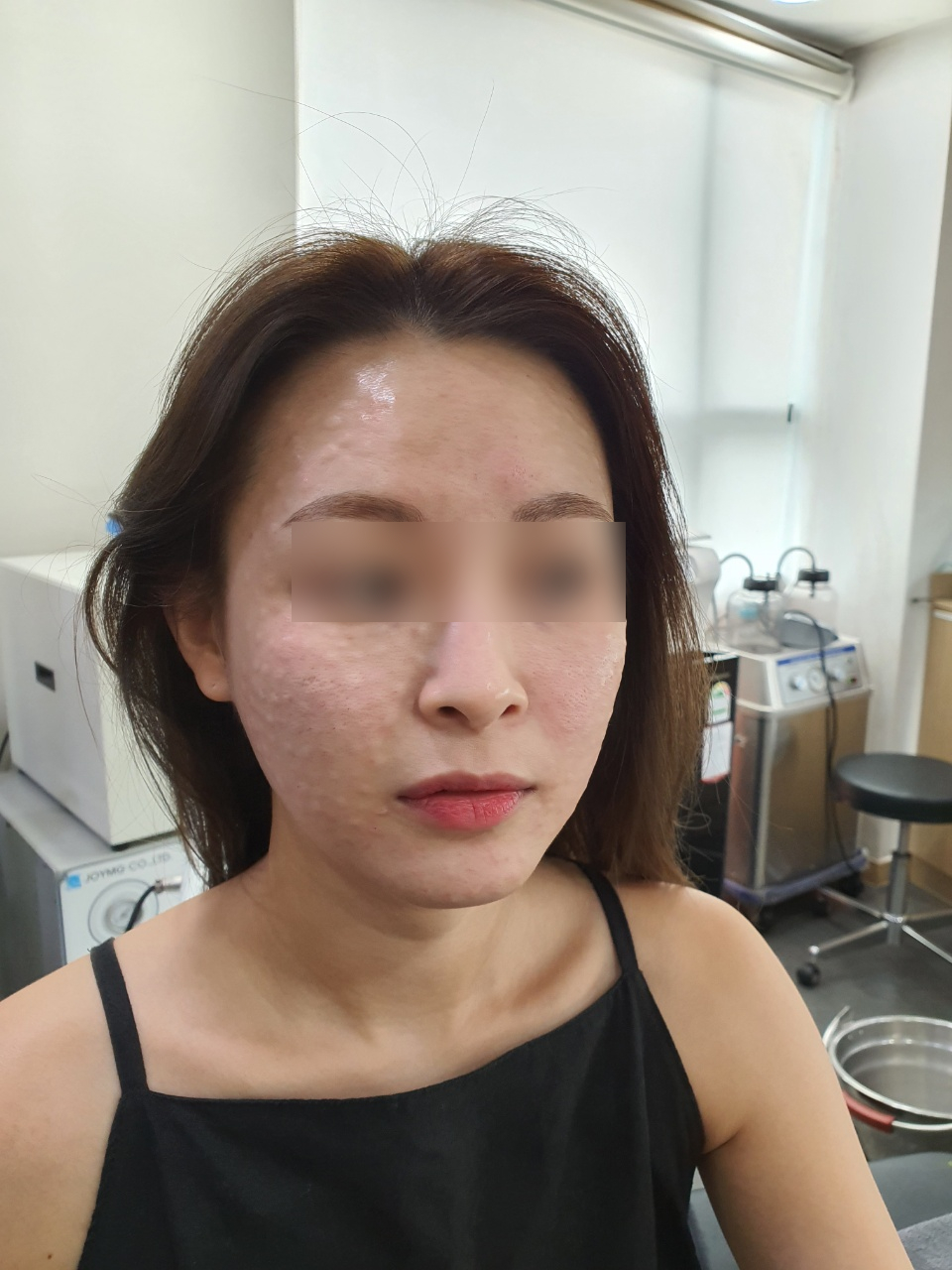 목동 스텔라 리쥬란  직후 모습은? 관련 이미지 3