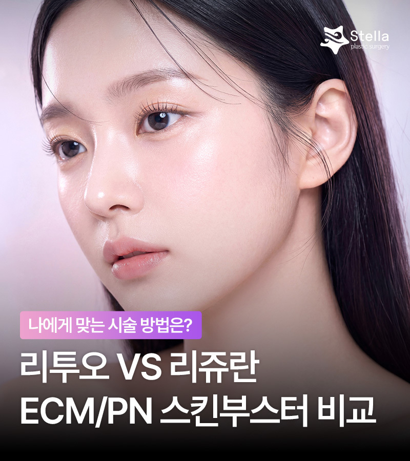 목동/영등포/여의도 스텔라의원★ 리투오or리쥬란 효과/회복/유지기간 비교 관련 이미지 1