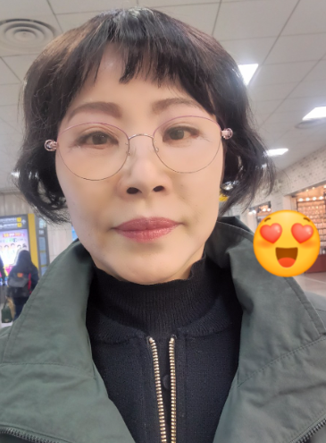 눈상담 받으러 왔다가 풀안면거상까지 하게된 60대중반 중년 어머님 (전/후) /목동 성형외과 스텔라성형 관련 이미지 22