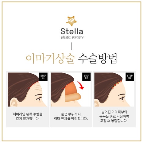 10년전으로 돌아갈 수 있다면, 돌아가시겠어요? 관련 이미지 4