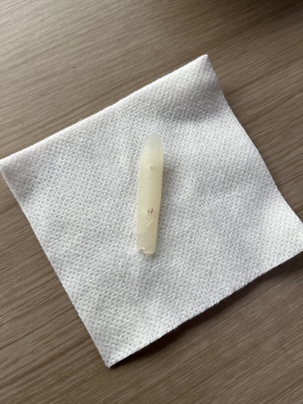 목동 성형외과 #코 보형물 제거 , 코 염증 현상 관련 이미지 1