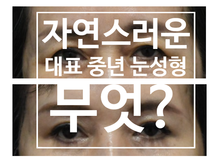 60대 눈처짐 수술후 인상이 강해보일까봐 걱정이라면? 관련 이미지 1