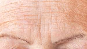 * Mok-dong / Omokgyo / Yeongdeungpo / Dangsan / Yangcheon Plastic Surgery Botox * image 2