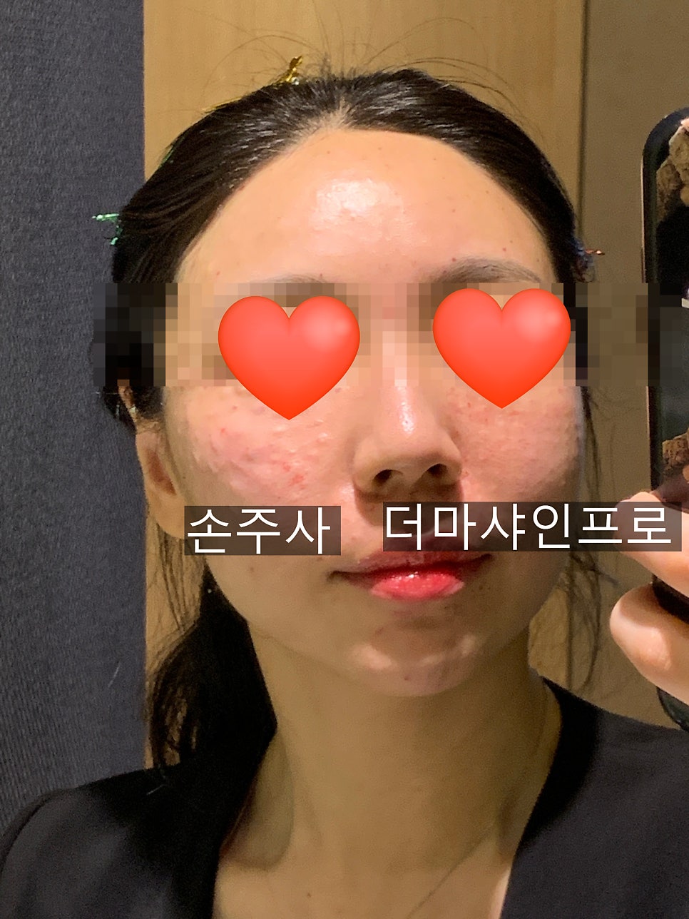 목동 스텔라 직원이 직접 받아본 콜라겐쥬베룩~&hearts; 관련 이미지 9