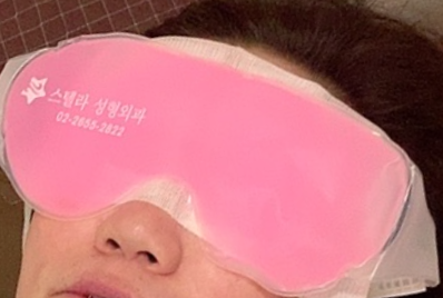 쌍커풀 수술 붓기 빨리 빠지는 꿀팁! &hearts; 관련 이미지 1