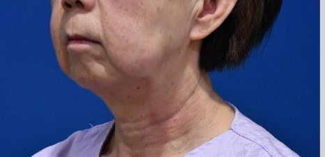 10년전으로 돌아갈 수 있다면, 돌아가시겠어요? 관련 이미지 16