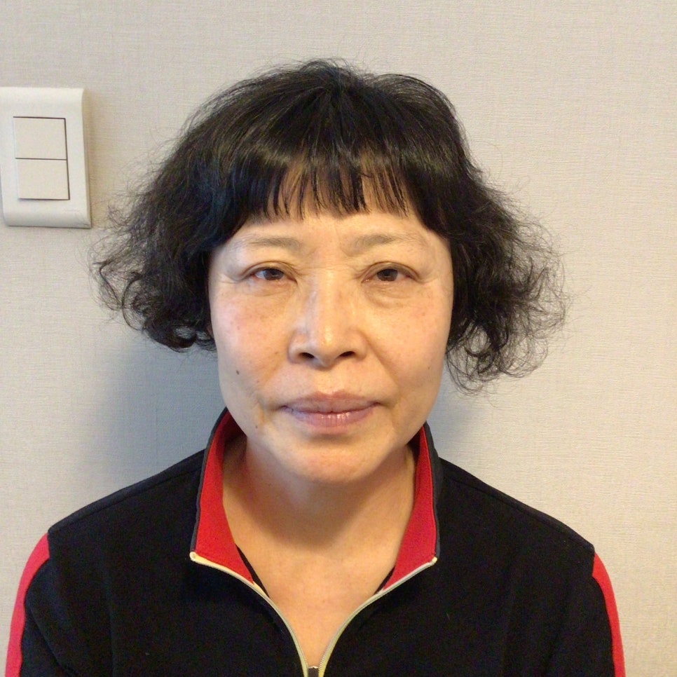 눈상담 받으러 왔다가 풀안면거상까지 하게된 60대중반 중년 어머님 (전/후) /목동 성형외과 스텔라성형 관련 이미지 6