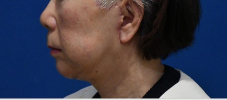 10년전으로 돌아갈 수 있다면, 돌아가시겠어요? 관련 이미지 13