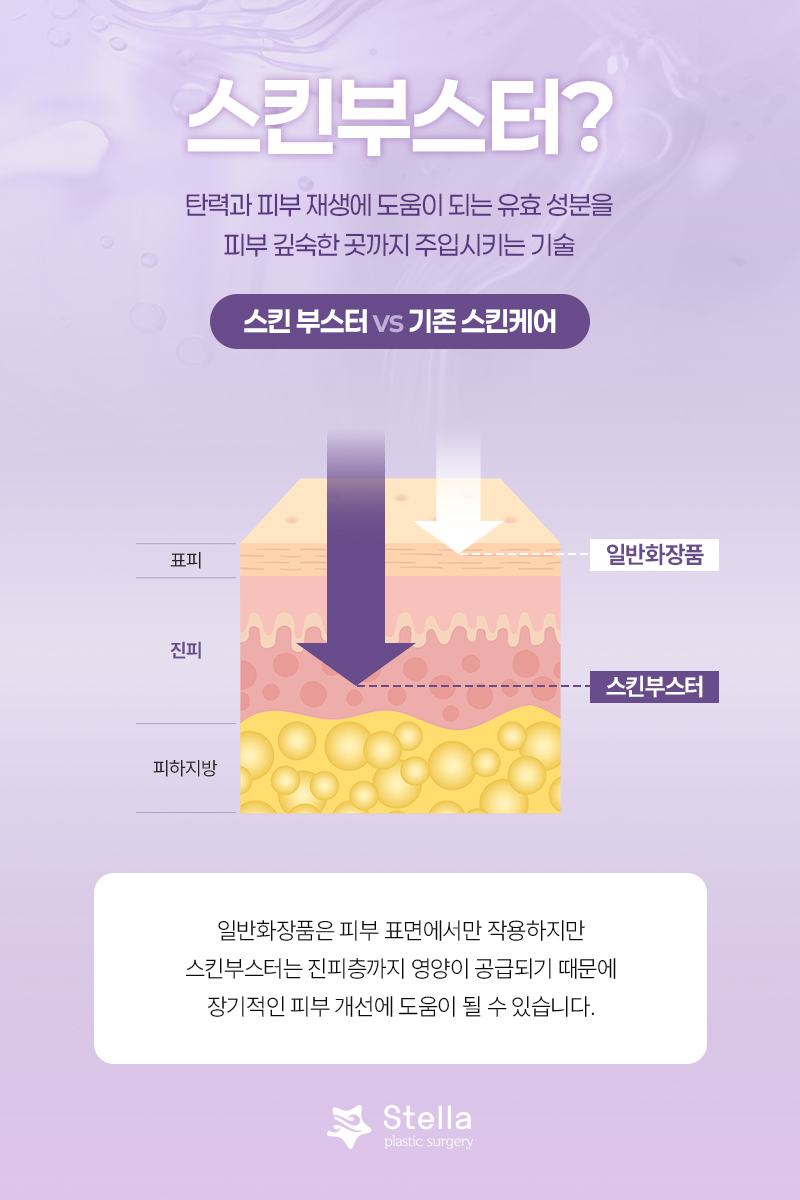Mok-dong/Omok-gyo Stella Rejuran/Juvelook/Water Glow/Skin Botox: Why Does It Need to Be Properly Delivered into the Dermis During the Procedure? image 2