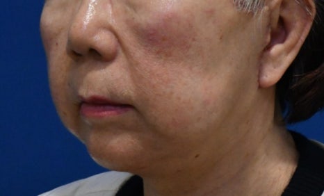 10년전으로 돌아갈 수 있다면, 돌아가시겠어요? 관련 이미지 17