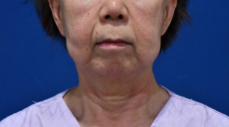 10년전으로 돌아갈 수 있다면, 돌아가시겠어요? 관련 이미지 14