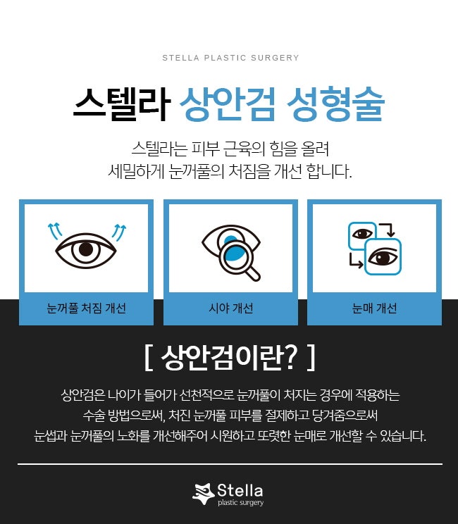 눈 수술 후, 빠른회복을 위한 방법은 ??  스텔라가 알려드릴게요!  (오목교 스텔라성형외과) 관련 이미지 17