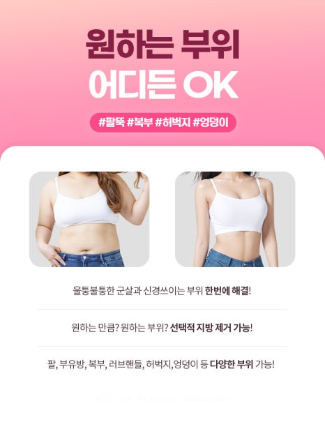 지방흡입하러 강남까지? 안전하게 대용량 흡입 + 빠른회복 ! ★ 수입장비 관련 이미지 5