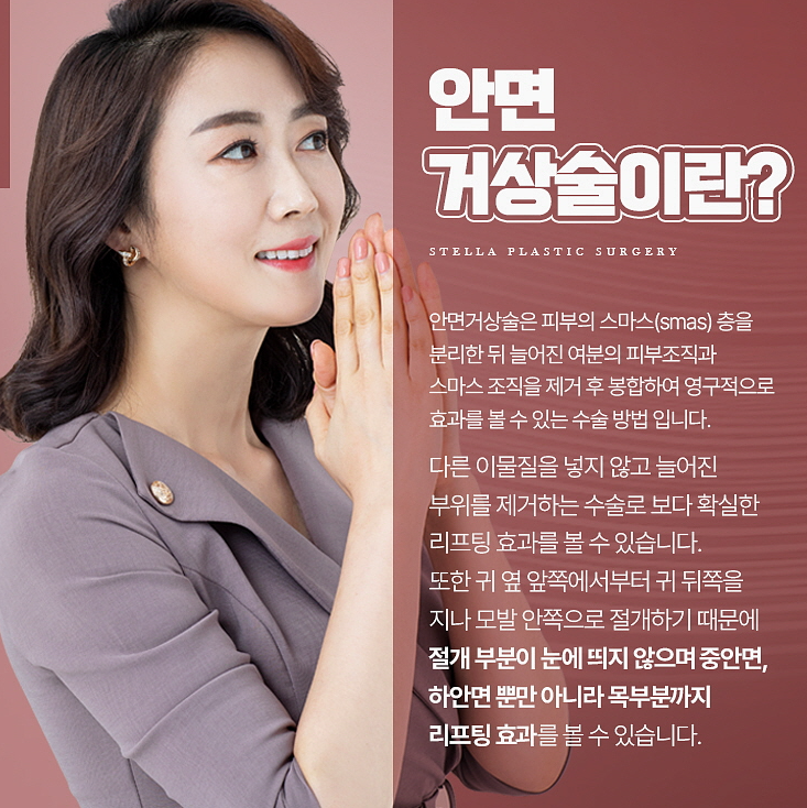 흔한 중년아빠의 안면거상 수술경과? 안면거상 많이하는 병원 관련 이미지 1