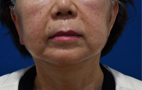 10년전으로 돌아갈 수 있다면, 돌아가시겠어요? 관련 이미지 15