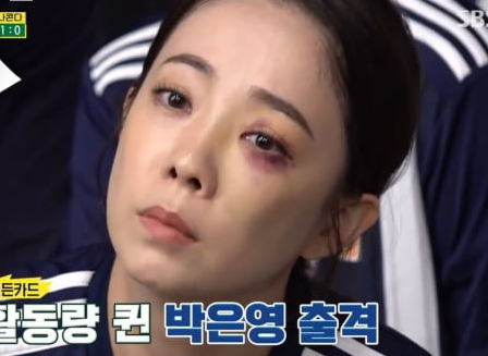 수술 후, 생기는 붓기와 멍 빨리 빼는 법! 관련 이미지 2