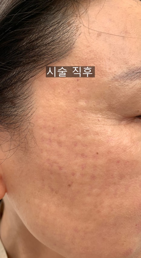 목동 스텔라 직원이 직접 받아본 콜라겐쥬베룩~&hearts; 관련 이미지 6