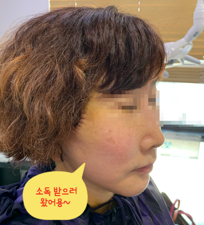 심부볼 처짐 해결 !! 화곡동 안면거상수술의 특별함은?(전/후사진) 관련 이미지 2