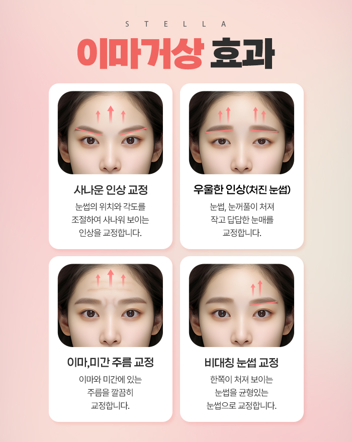 목동,화곡동,영등포 성형외과 /(눈성형) 이마거상 엔도타인 정품 확인하는방법 꿀팁! 필수 (수술직후 사진 有) 스텔라성형외과 관련 이미지 13