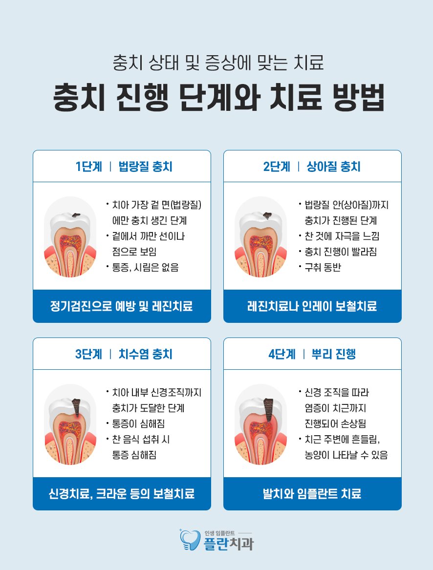 앞니어금니 레진비용 알아봅시다 관련 이미지 3