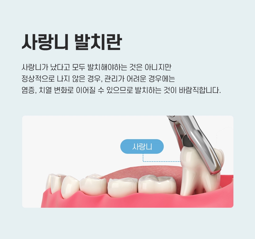 서울사랑니치과 통증 줄여 원활히 회복하도록 관련 이미지 3
