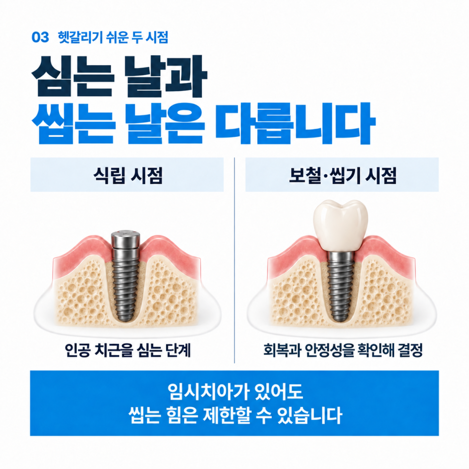 발치 후 임플란트 시기, 바로 심는 경우와 기다리는 경우 관련 이미지 4