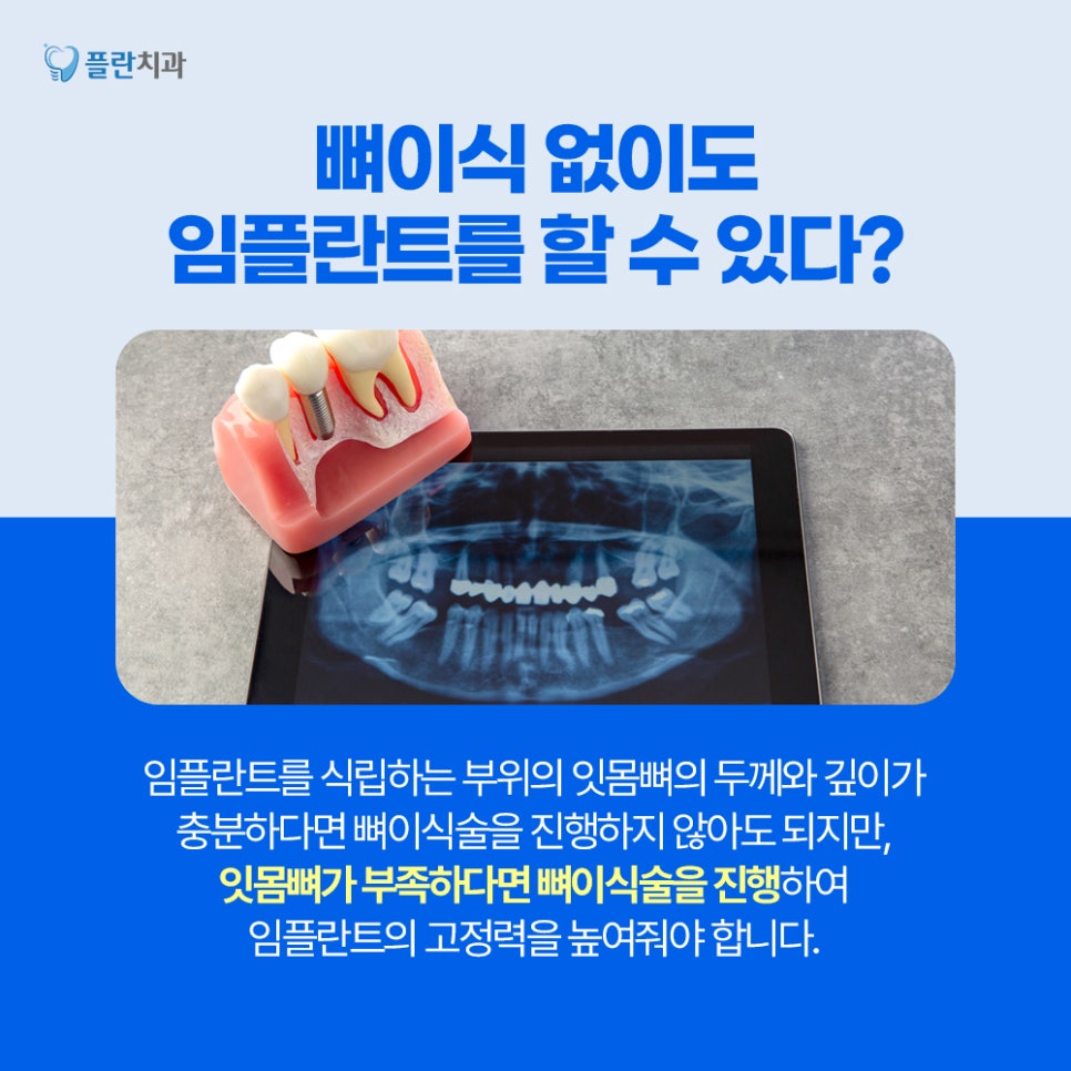 임플란트 전, 뼈이식술 꼭 진행해야 하는 이유는? 관련 이미지 3