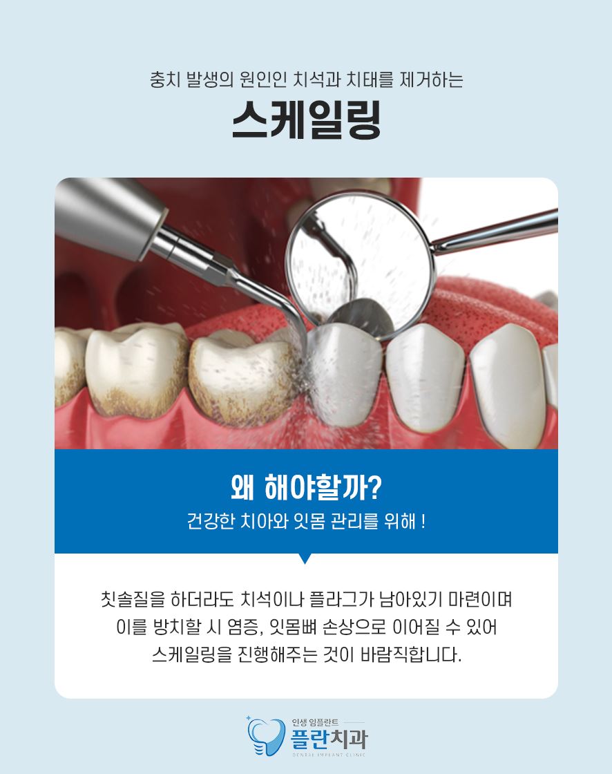 스케일링소요시간 주기 알아봅시다 관련 이미지 3