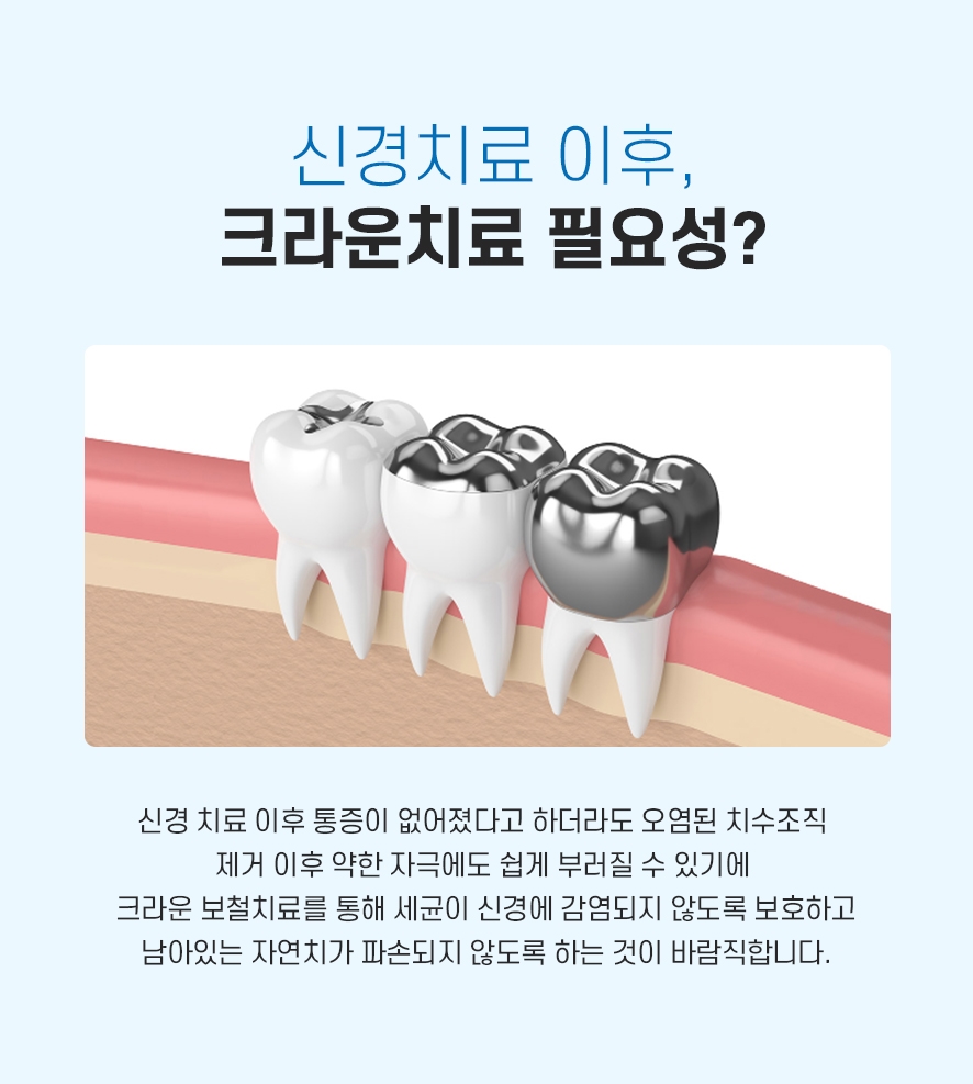 신경치료후크라운 꼭 해야 하나요? 관련 이미지 5