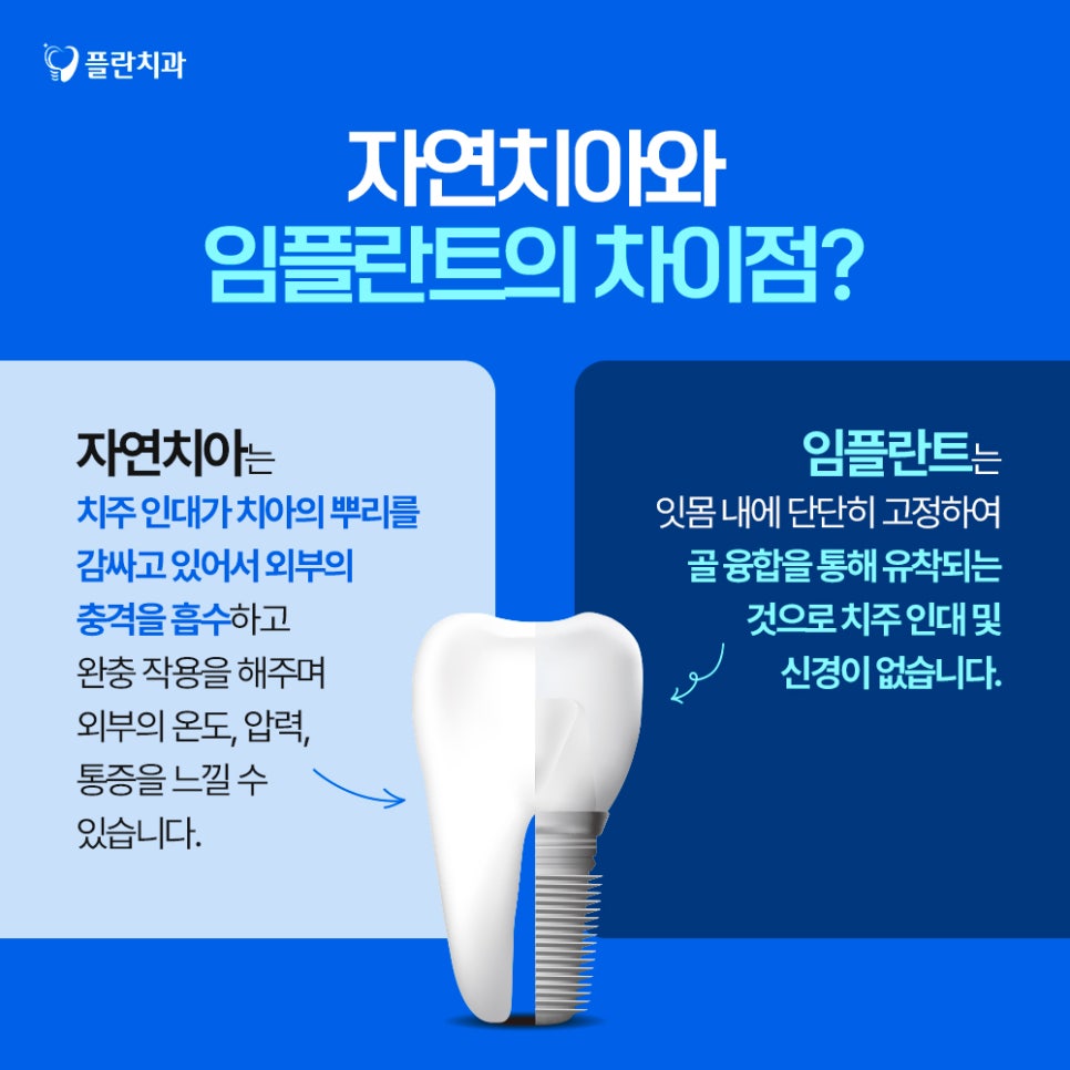 임플란트의 치료방법과 구조적 특징에 대하여 관련 이미지 3