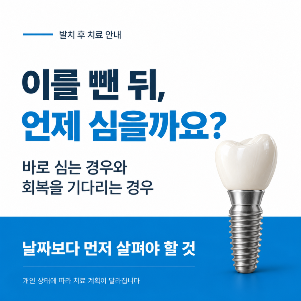 발치 후 임플란트 시기, 바로 심는 경우와 기다리는 경우 관련 이미지 1