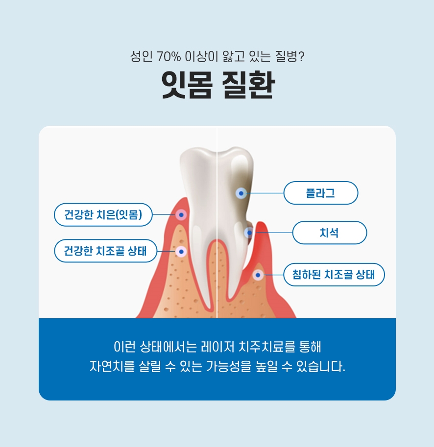 잇몸에서피 걱정이라면 관련 이미지 3