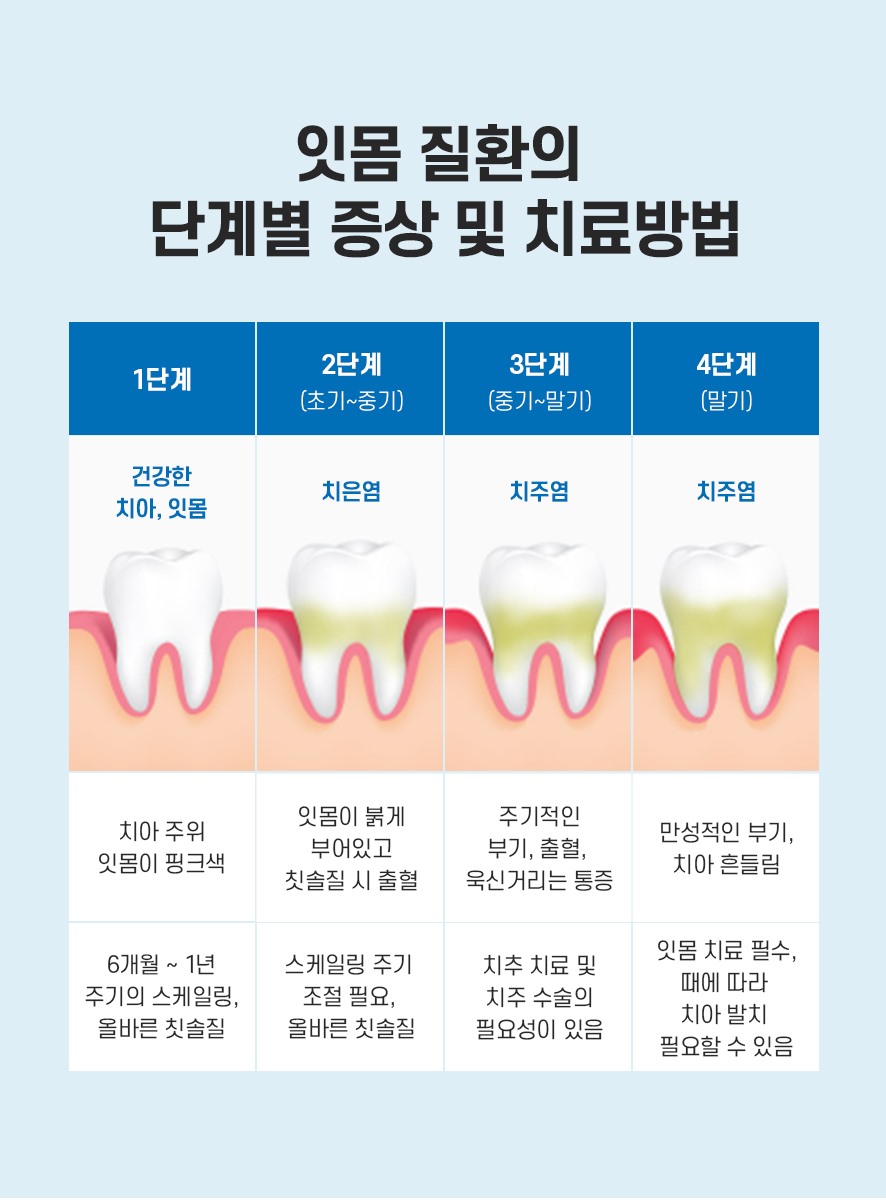 선릉역치과에서 치주염치은염차이 알려드려요 관련 이미지 4