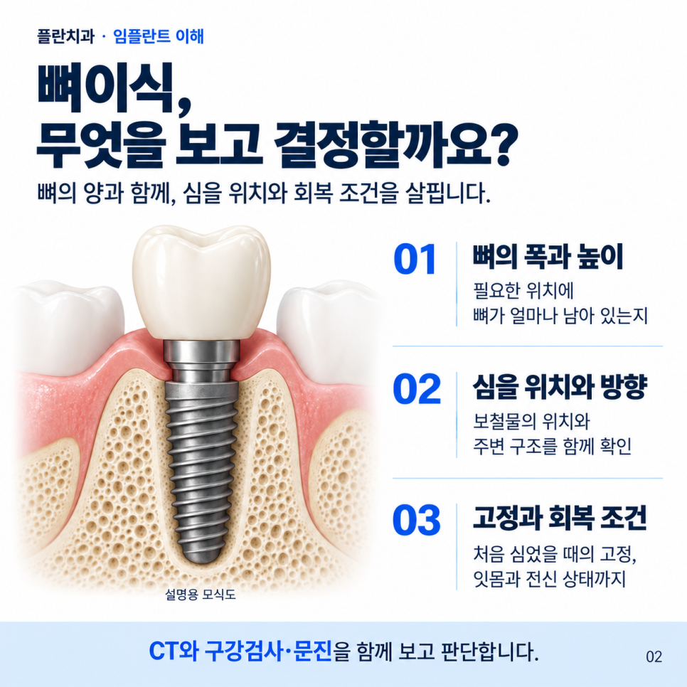 임플란트 뼈이식, 꼭 해야 할까요?압구정 치과에서 알려드립니다. 관련 이미지 2