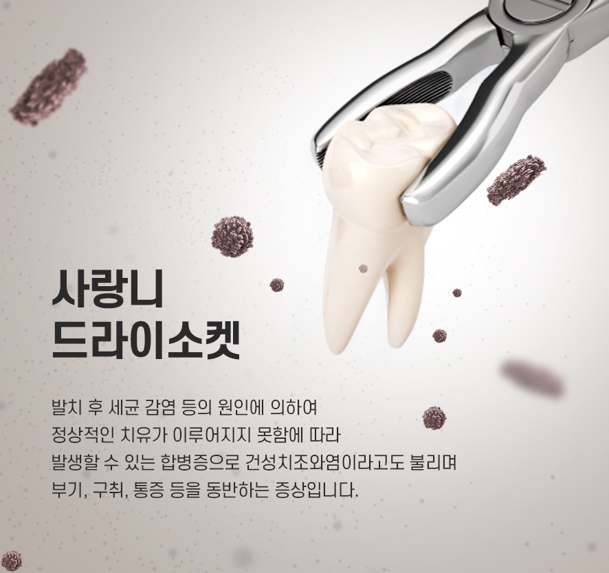 사랑니 발치 후 염증 통증 드라이소켓일까 관련 이미지 5