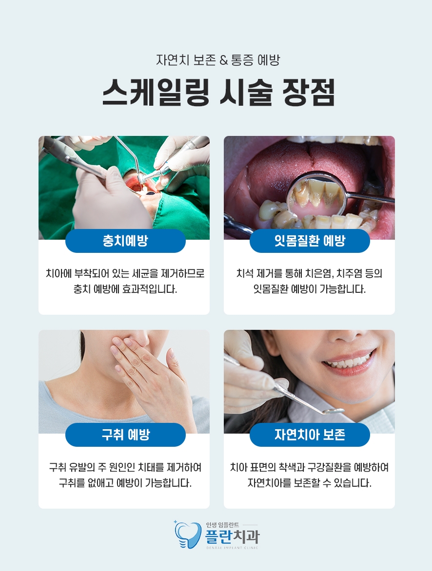 치과스케일링가격 보험 적용되니까 관련 이미지 4