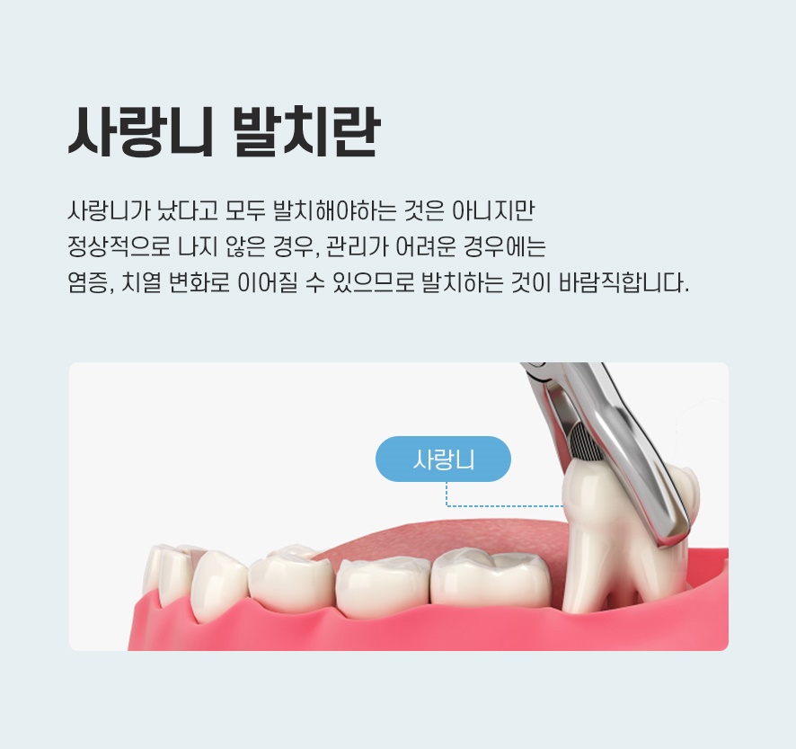 사랑니 발치 후 염증 통증 드라이소켓일까 관련 이미지 3