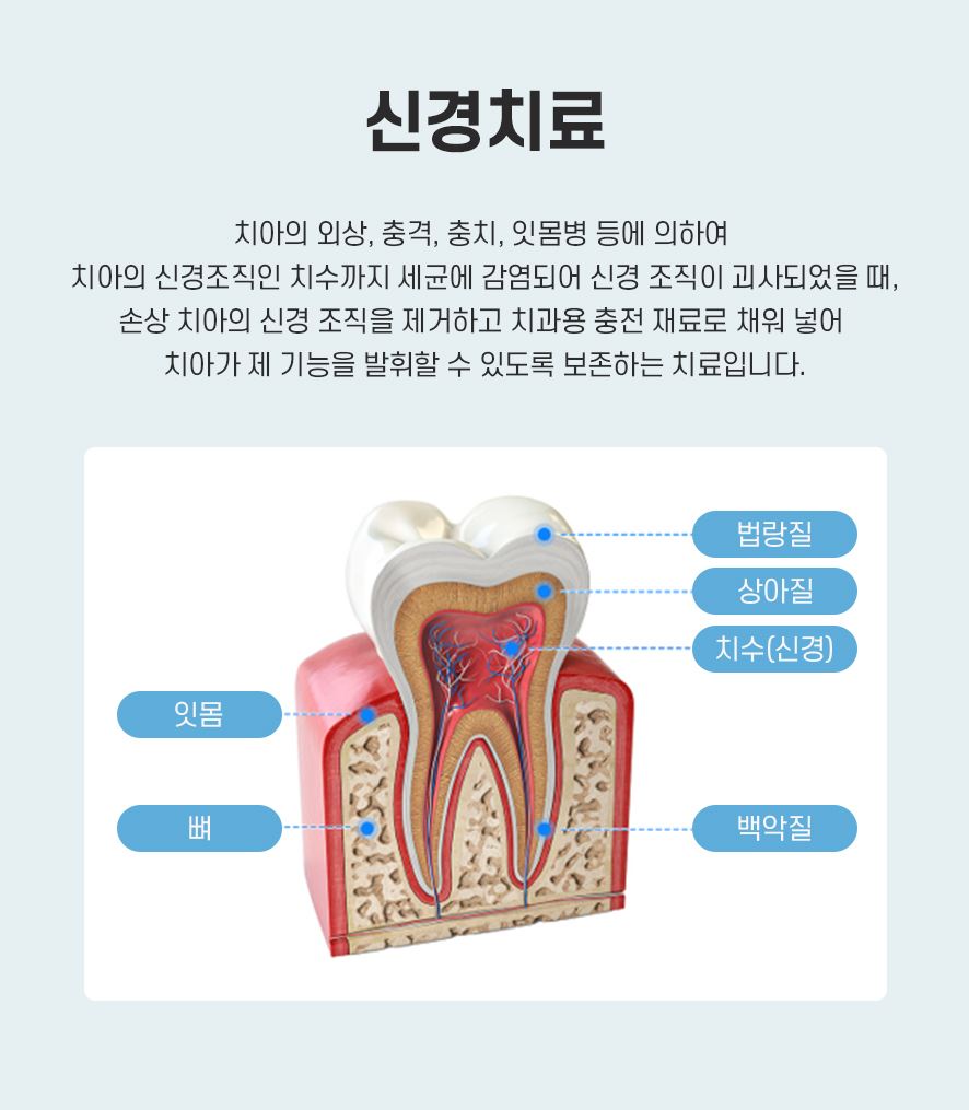 신경치료실비 처리 가능할까? 관련 이미지 3