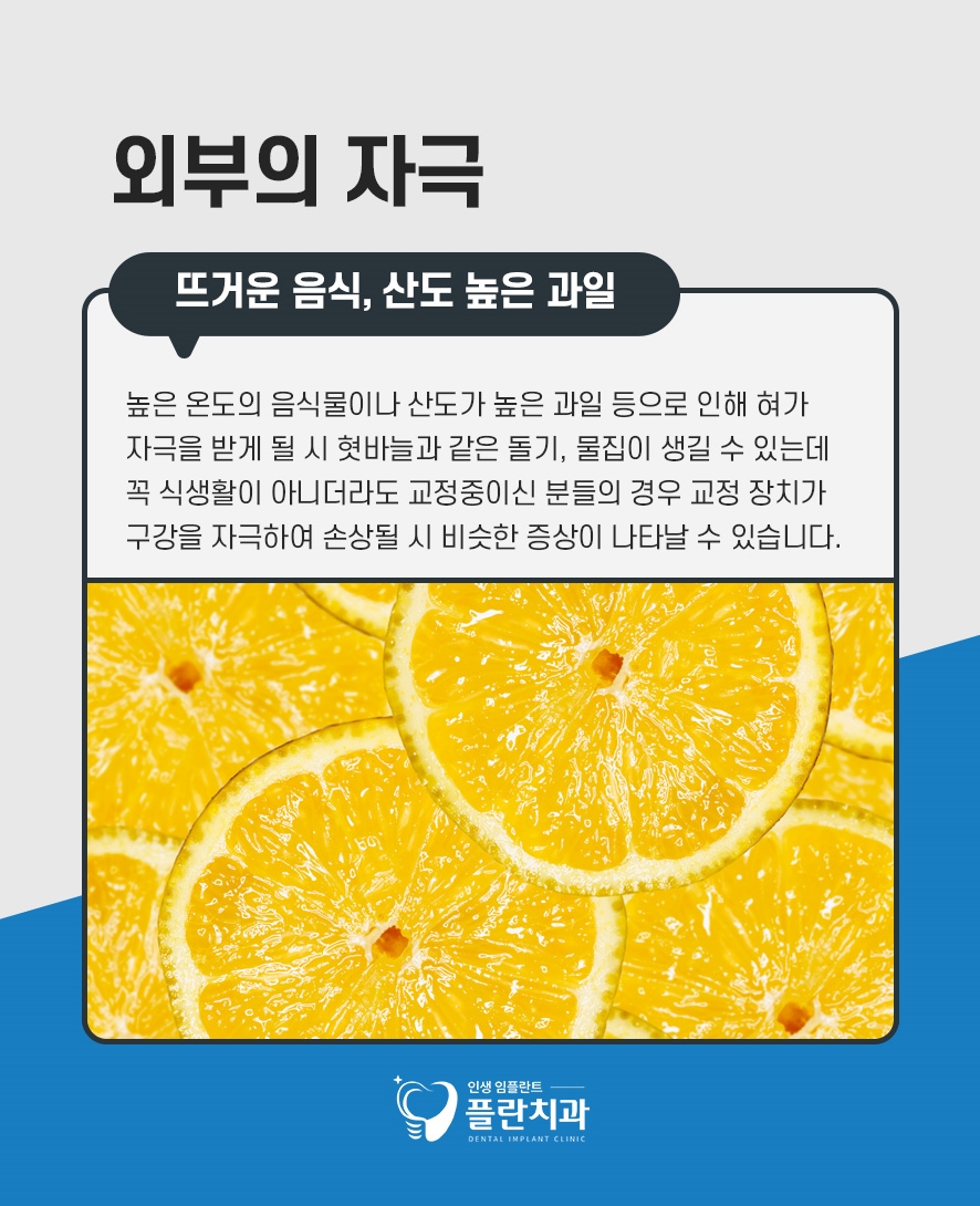 혀밑돌기 물집 원인과 대처 방법은 관련 이미지 3