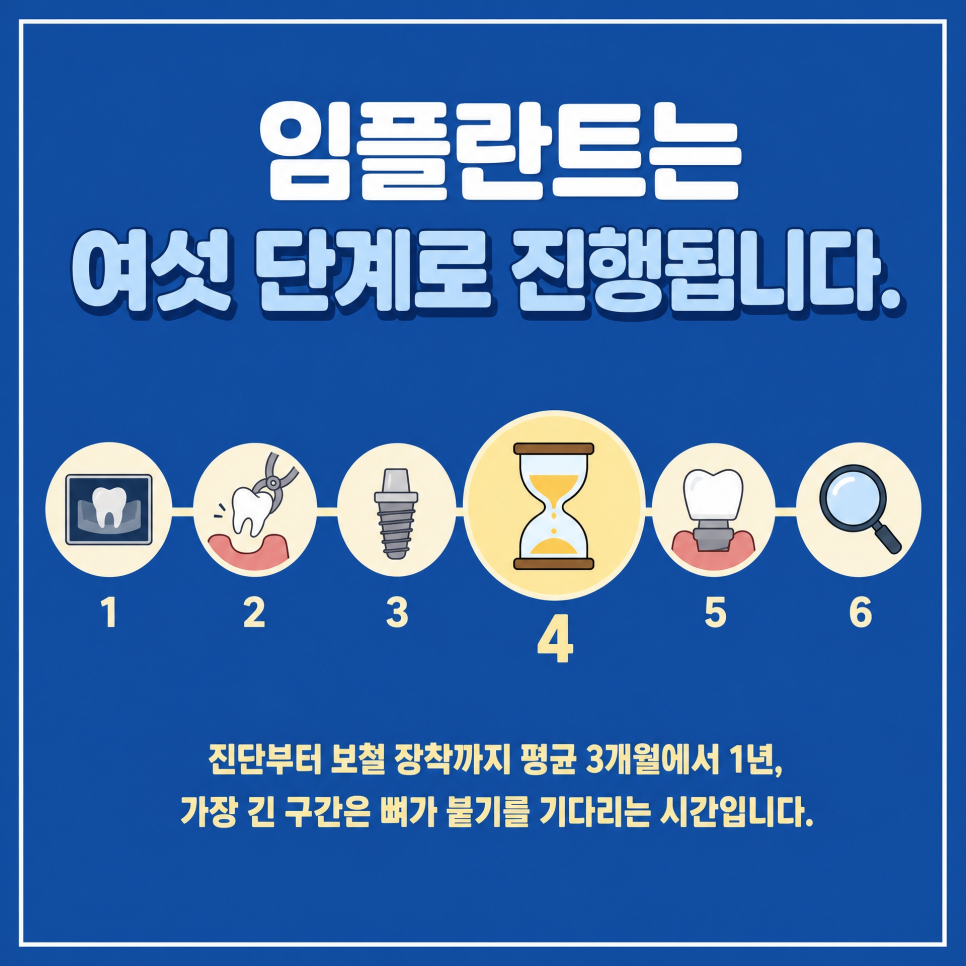 The Complete Implant Process, Organized by a Dental Clinic at Sinsa Station | How Long Does It Take? image 1