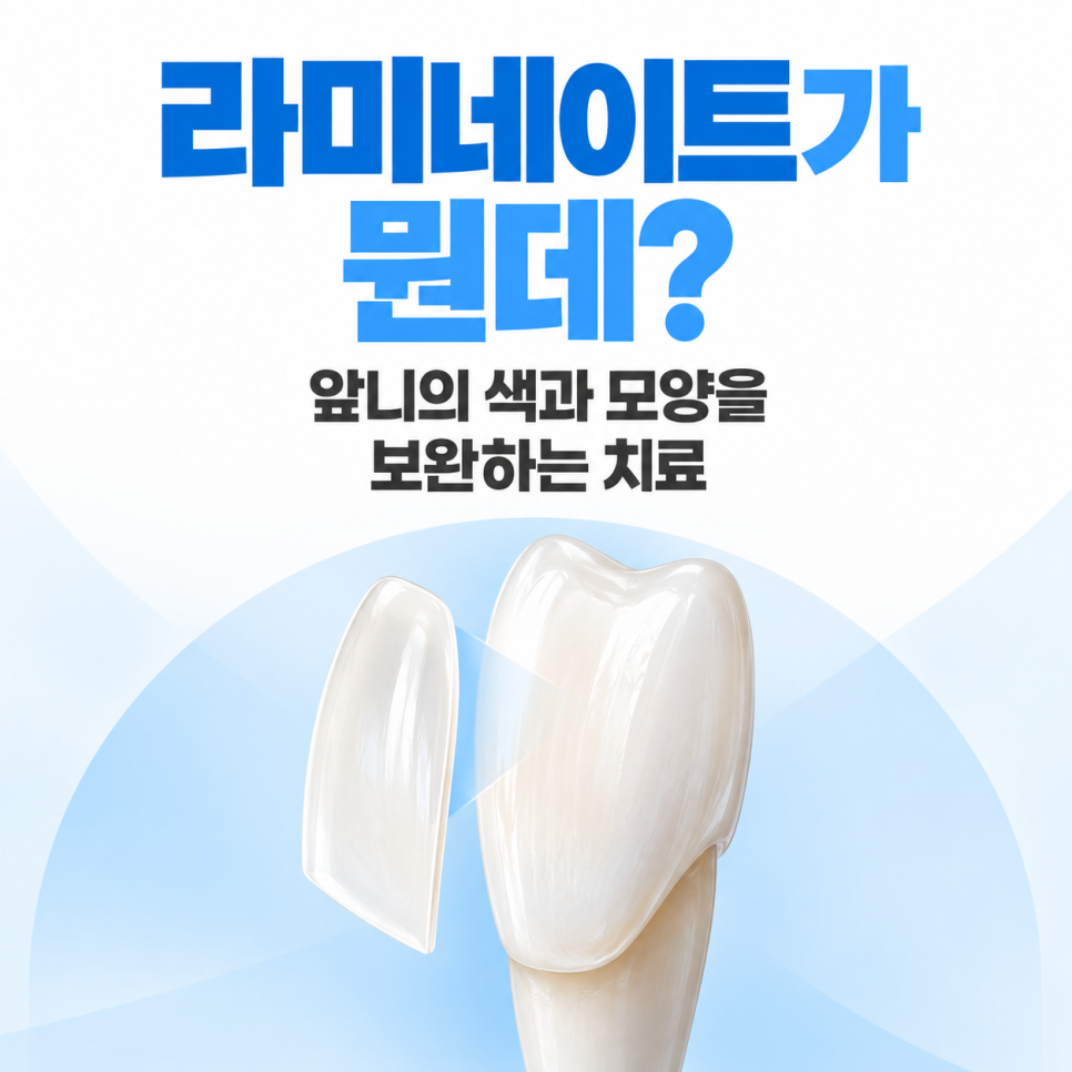 라미네이트란? 치아에 뭘 붙이는 건가요? 관련 이미지 1