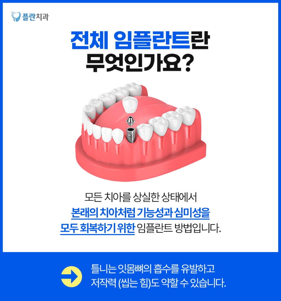 서울치과 전체임플란트 비용 꼼꼼하게 확인해야 하는 이유는? 관련 이미지 2