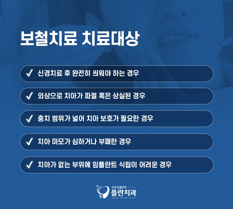 앞니벌어짐레진 치료로 개선할 수 있을까 관련 이미지 4