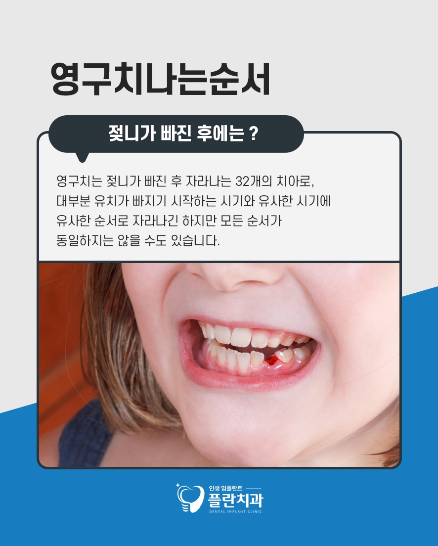 영구치나는순서 유치빠지는순서 시기 총정리 관련 이미지 3