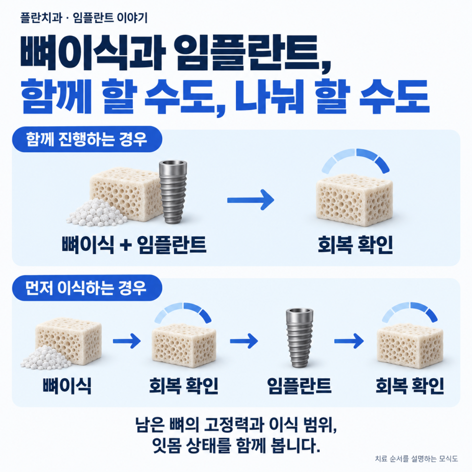 임플란트 뼈이식, 꼭 해야 할까요?압구정 치과에서 알려드립니다. 관련 이미지 4
