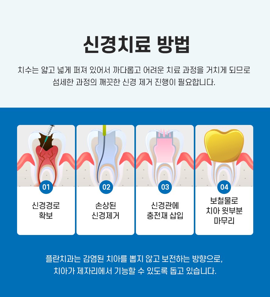 충치치료 시 신경치료기간 얼마나 걸리나요? 관련 이미지 5
